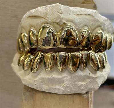Anna’s Diamond (Grillz)